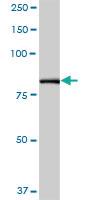 Anti-PFKP Mouse Polyclonal Antibody