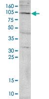 Anti-PADI4 Rabbit Polyclonal Antibody