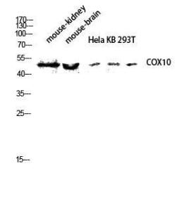 Western blot analysis of mouse kidney, mouse brain, Hela KB 293T lysis using Anti-COX10 Antibody