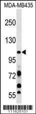 Anti-PIK3CB Rabbit Polyclonal Antibody