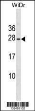 Anti-EPO Rabbit Polyclonal Antibody (FITC (Fluorescein Isothiocyanate))