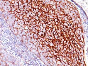 Immunohistochemical analysis of formalin-fixed, paraffin-embedded human tonsil using Anti-CD35 Antibody [E11]