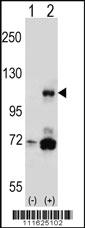 Anti-PIK3CB Rabbit Polyclonal Antibody