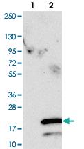 Anti-SPCS1 Rabbit Polyclonal Antibody