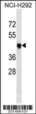 Anti-Protein T Mouse Monoclonal Antibody [clone: 394CT14.1.4]