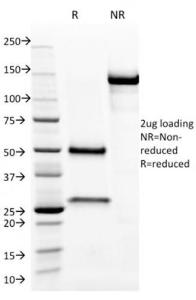 Anti-Aurora B Mouse Monoclonal Antibody [Clone: AURKB/1593]