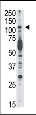 Anti-PI3KCD Rabbit Polyclonal Antibody