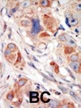 Anti-PI3KCD Rabbit Polyclonal Antibody