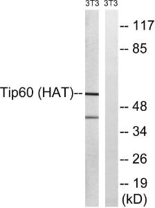 Anti-Tip60 antibody