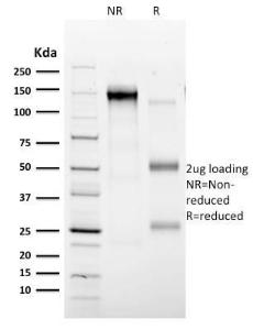 SDS-PAGE analysis of Anti-CD35 Antibody [E11] under non-reduced and reduced conditions; showing intact IgG and intact heavy and light chains, respectively. SDS-PAGE analysis confirms the integrity and purity of the antibody