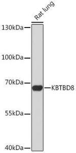 Western blot analysis of extracts of Rat lung, using Anti-KBTBD8 Antibody (A305587) at 1:1,000 dilution. The secondary antibody was Goat Anti-Rabbit IgG H&L Antibody (HRP) at 1:10,000 dilution.