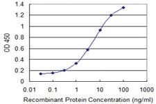 Anti-IL4R Mouse Monoclonal Antibody [clone: 1D10]