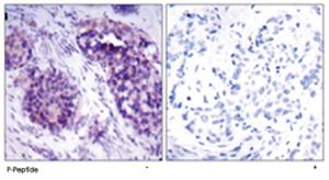 Anti-BCL2L1 Rabbit Polyclonal Antibody