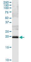 Anti-SSH2 Polyclonal Antibody Pair