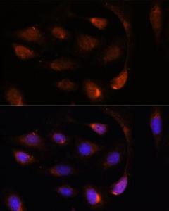 Immunofluorescence analysis of U-2 OS cells using Anti-SH3BGRL Antibody (A307967) at a dilution of 1:100 DAPI was used to stain the cell nuclei (blue)