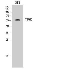 Anti-Tip60 antibody