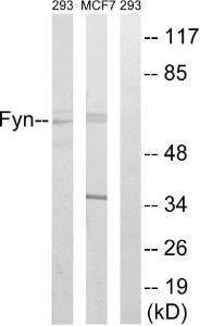 Western blot analysis of lysates from MCF-7 and 293 cells using Anti-Fyn Antibody. The right hand lane represents a negative control, where the antibody is blocked by the immunising peptide.