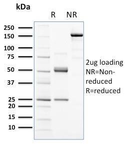 SDS-PAGE analysis of Anti-c-Kit Antibody [KIT/2672] under non-reduced and reduced conditions; showing intact IgG and intact heavy and light chains, respectively. SDS-PAGE analysis confirms the integrity and purity of the antibody