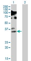 Anti-FRAT2 Mouse Polyclonal Antibody