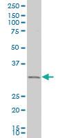 Anti-EXOSC2 Mouse Polyclonal Antibody