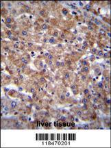 Anti-PLEKHA4 Rabbit Polyclonal Antibody (FITC (Fluorescein Isothiocyanate))