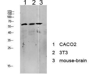 Anti-Tip60 antibody