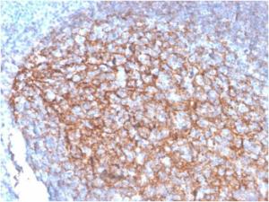 Immunohistochemical analysis of formalin-fixed, paraffin-embedded human tonsil using Anti-CD35 Antibody [SPM554]