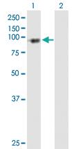 Anti-PFKP Mouse Polyclonal Antibody