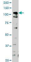 Anti-HIPK1 Mouse Monoclonal Antibody [clone: 1F2]