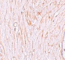 Anti-ZBTB7A Rabbit Polyclonal Antibody