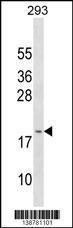 Anti-GAGE3 Rabbit Polyclonal Antibody (Biotin)