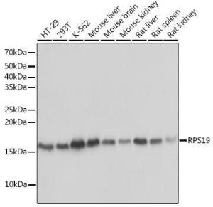 Western blot analysis of extracts of various cell lines, using Anti-RPS19 Antibody [ARC0820] (A306700) at 1:1,000 dilution The secondary antibody was Goat Anti-Rabbit IgG H&L Antibody (HRP) at 1:10,000 dilution Lysates/proteins were present at 25 µg per lane