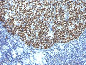 Immunohistochemical analysis of formalin-fixed, paraffin-embedded human tonsil using Anti-Bcl-6 Antibody [SPM602]