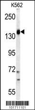 Anti-PI3KCG Rabbit Polyclonal Antibody