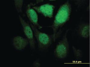 Anti-HIPK1 Mouse Monoclonal Antibody [clone: 1F2]