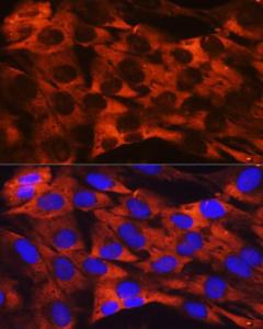 Immunofluorescence analysis of C6 cells using Anti-RPS19 Antibody [ARC0820] (A306700) at a dilution of 1:100 (40x lens) DAPI was used to stain the cell nuclei (blue)