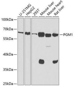 Western blot analysis of extracts of various cell lines, using Anti-PGM1 Antibody (A307968) at 1:1,000 dilution