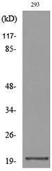 Anti-CMTM6 antibody