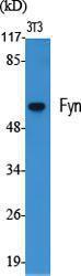 Western blot analysis of various cells using Anti-Fyn Antibody