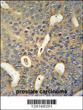 Anti-MICALL1 Rabbit Polyclonal Antibody (FITC (Fluorescein Isothiocyanate))