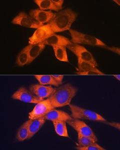 Immunofluorescence analysis of NIH-3T3 cells using Anti-RPS19 Antibody [ARC0820] (A306700) at a dilution of 1:100 (40x lens) DAPI was used to stain the cell nuclei (blue)