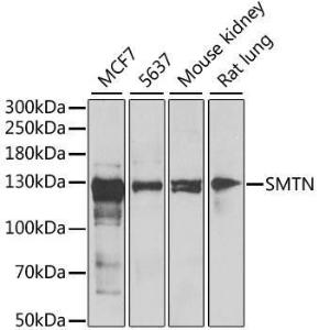 Western blot analysis of extracts of various cell lines, using Anti-Smoothelin Antibody (A12010) at 1:1,000 dilution