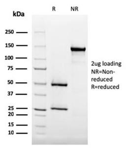 SDS-PAGE analysis of Anti-CD35 Antibody [SPM554] under non-reduced and reduced conditions; showing intact IgG and intact heavy and light chains, respectively. SDS-PAGE analysis confirms the integrity and purity of the antibody