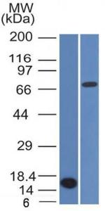 Antibody anti-BCL-6 BCL61475 100 µg