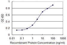 Anti-IL4R Mouse Monoclonal Antibody [clone: 4H8]