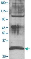 Anti-MBD3 Rabbit Polyclonal Antibody