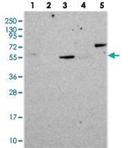 Anti-CORO2A Rabbit Polyclonal Antibody