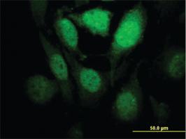 Anti-HIPK1 Mouse Monoclonal Antibody [clone: 1F2]