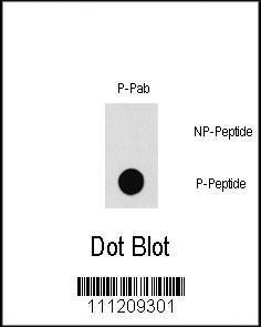 Anti-PAK1 Rabbit Polyclonal Antibody (FITC (Fluorescein))