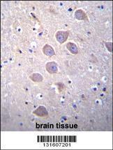 Anti-PCDHA5 Rabbit Polyclonal Antibody (HRP (Horseradish Peroxidase))